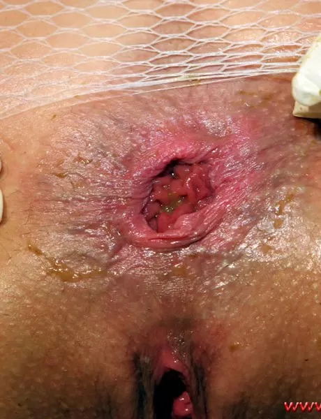 Девушка-одиночка работает кулаком по своей выпавшей заднице, наклонившись